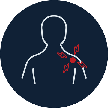 metti_marco_dolore_ spalla_ cuffia_ rotatori