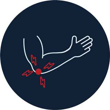 Metti_marco_epicondilite